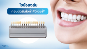 Before veneer treatment consultation - Dental Select Pattaya