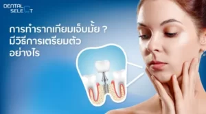 How to prepare for dental implant surgery - Dental Select Pattaya