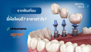 Choosing dental implant brand in Pattaya - Dental Select