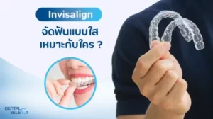 Invisalign clear aligners Pattaya - Dental Select