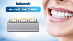 Dental veneer preparation - Dental Select Pattaya