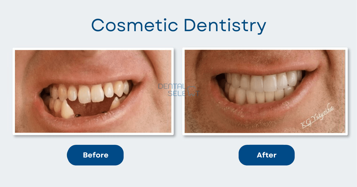 cosmetic dentistry
