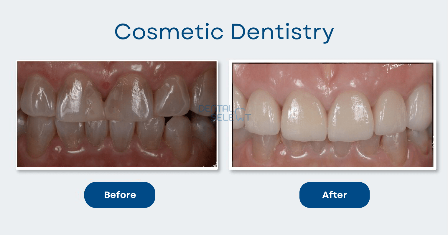 cosmetic dentistry