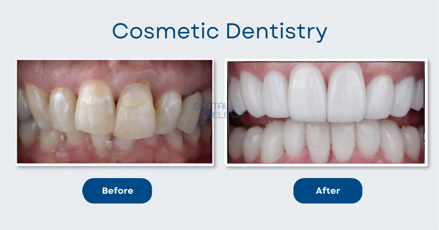 cosmetic dentistry