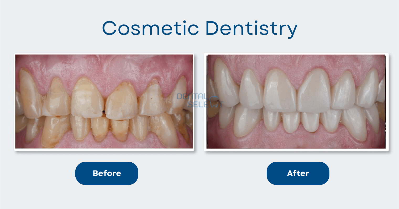 cosmetic dentistry