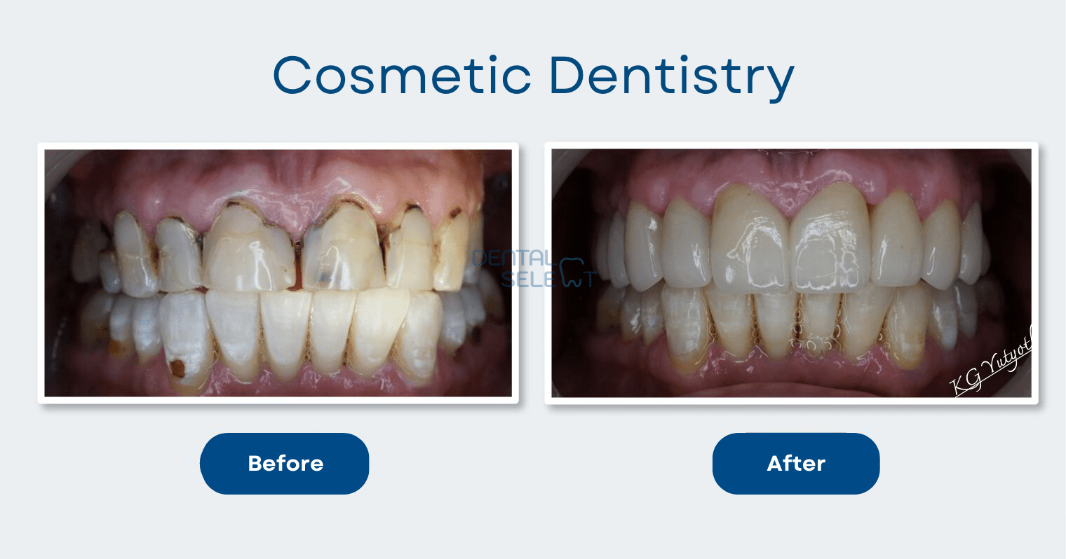 cosmetic dentistry