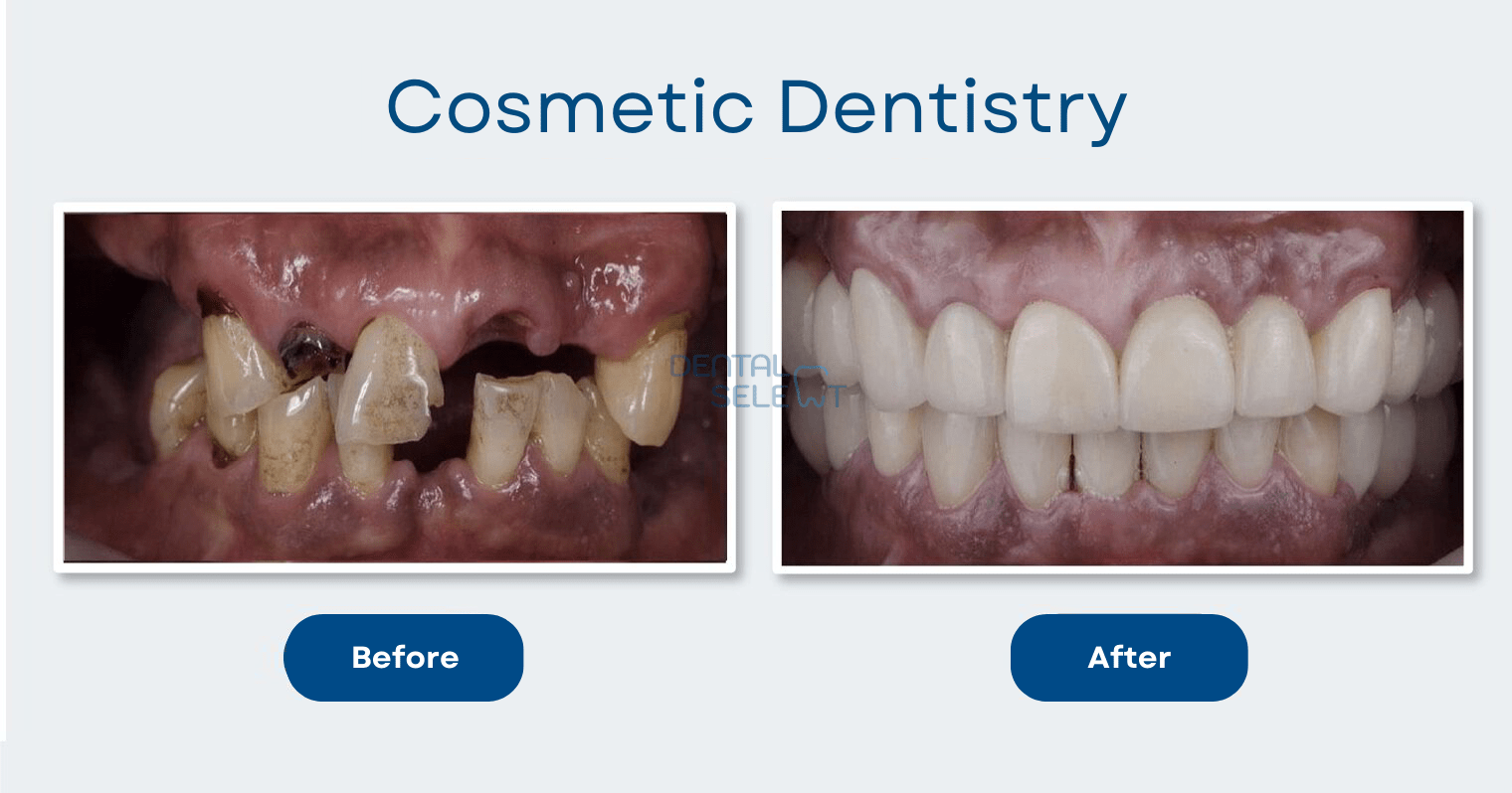 cosmetic dentistry