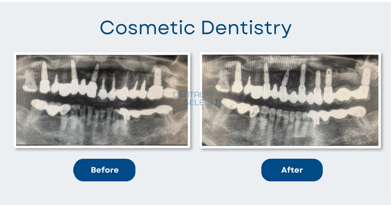 cosmetic dentistry