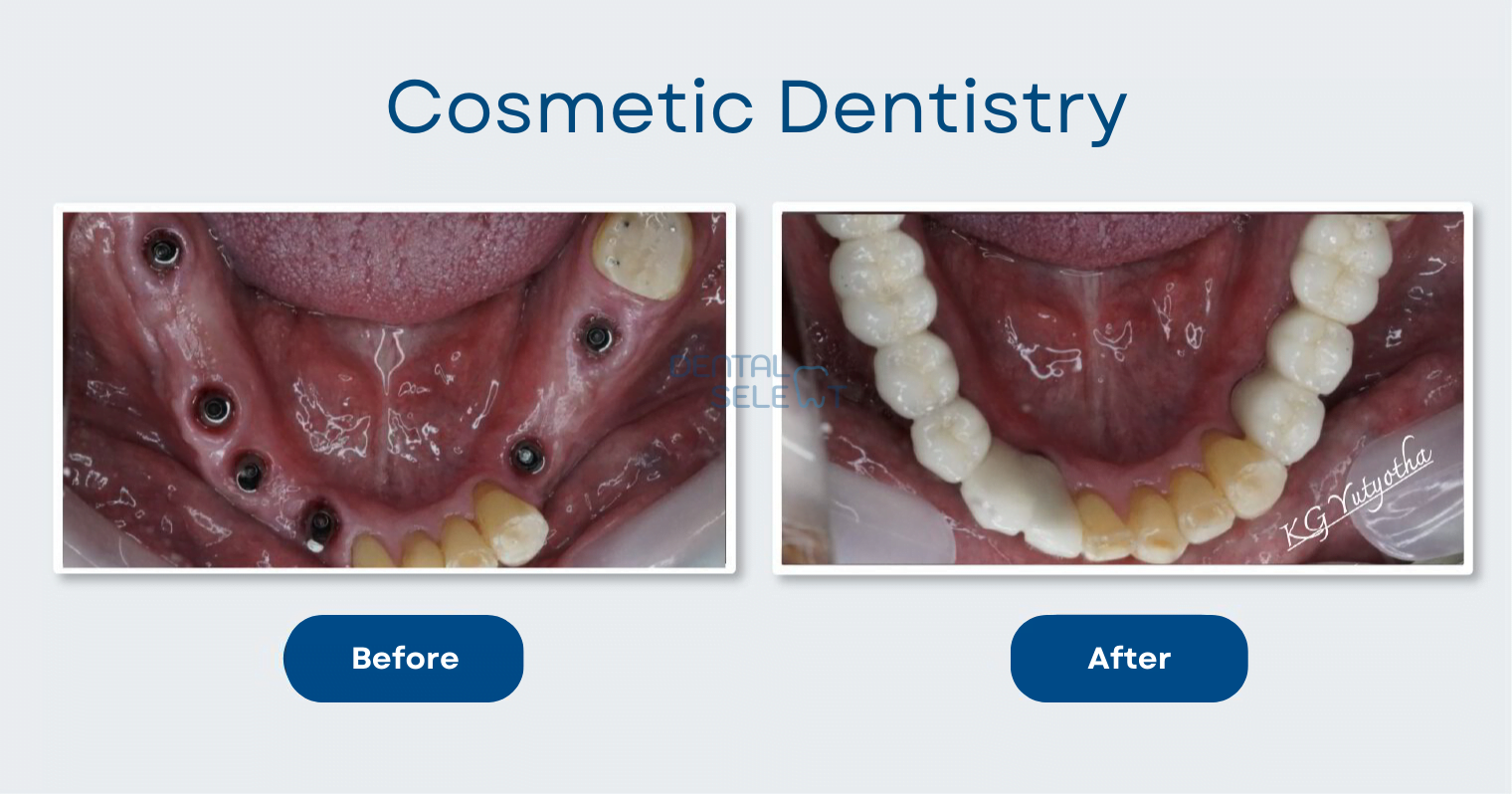 cosmetic dentistry