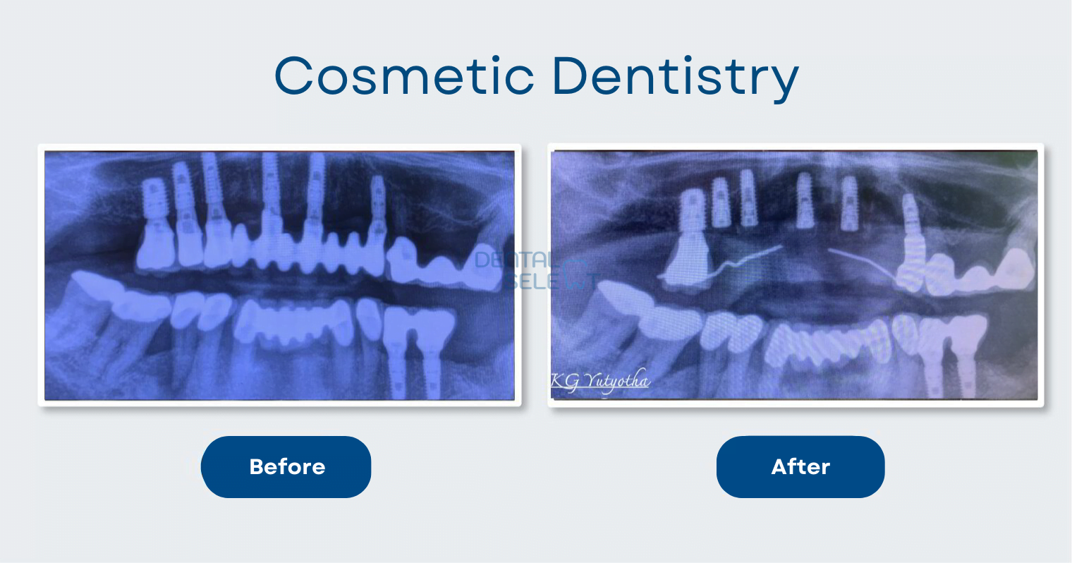 cosmetic dentistry