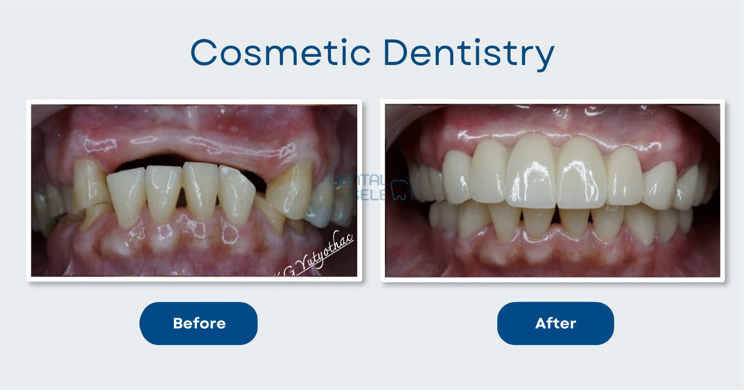 cosmetic dentistry