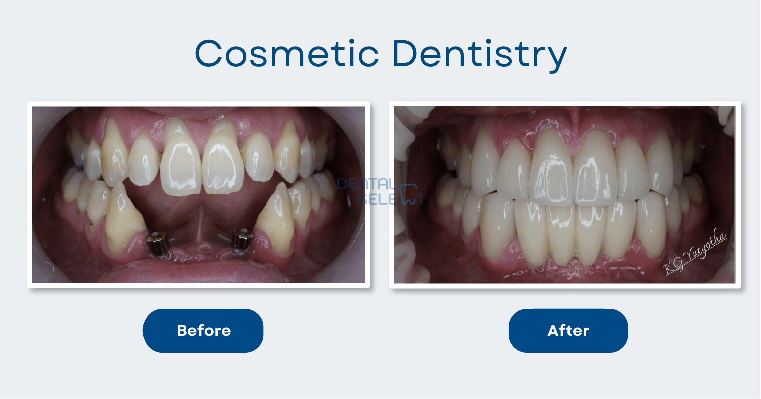 cosmetic dentistry