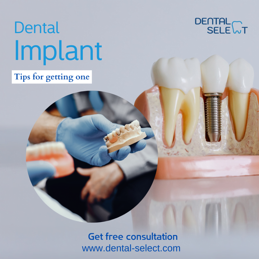 implants tips