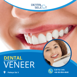 Dental veneers in Pattaya - Dental Select Clinic