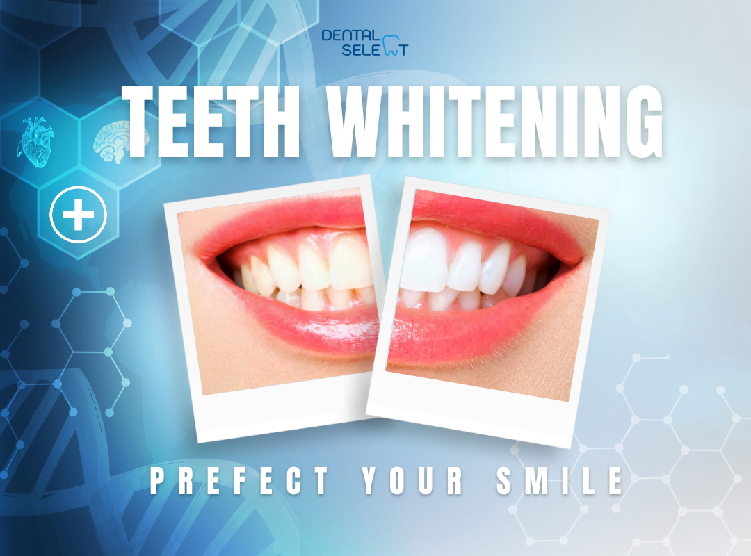 Professional teeth whitening information for dental patients in Pattaya