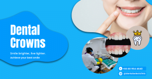 Dental crown treatment - Dental Select Pattaya clinic