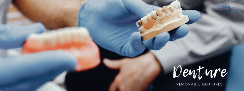 removable dentures